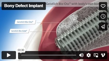 Bony defect implant